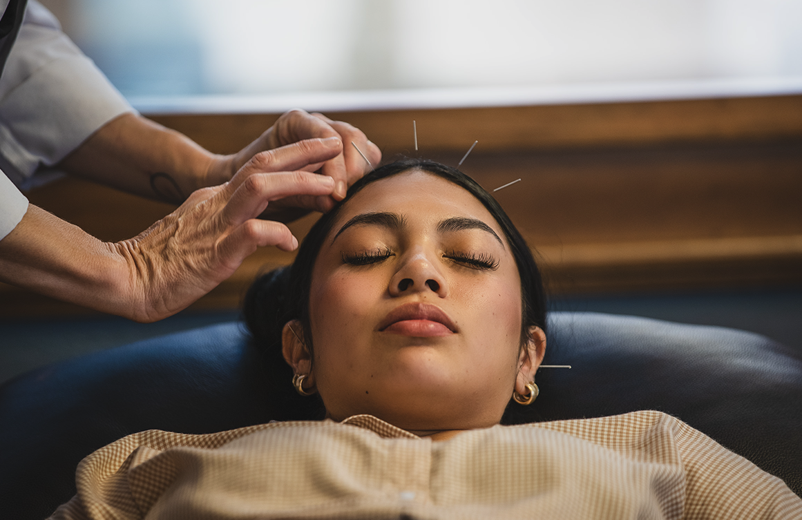 Relaxing acupuncture treatment
